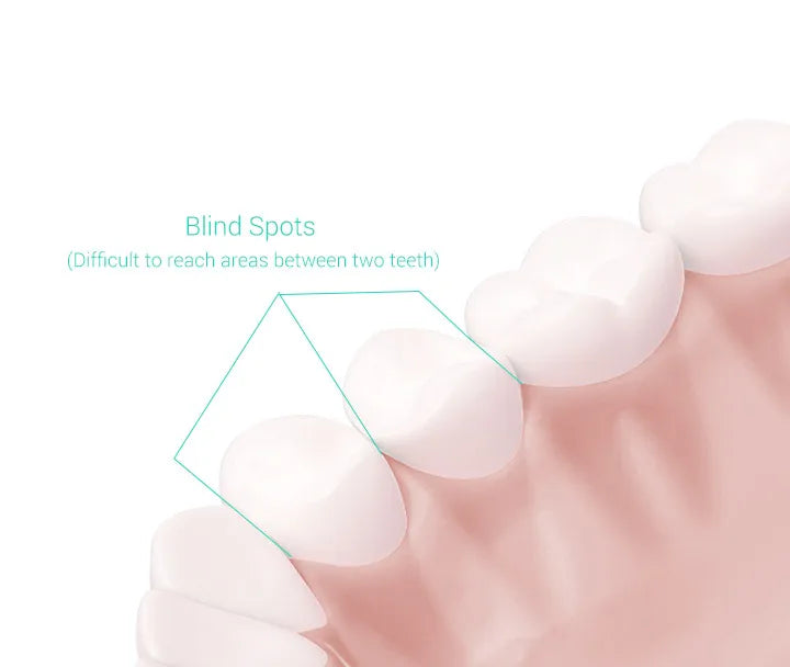XIAOMI T300 Electric Toothbrush